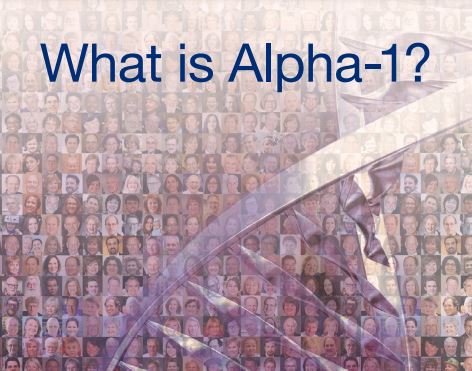 What you need to know about Alpha-1 Antitrypsin Deficiency